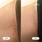 Transform your skin with Bushbalm Ingrown Hair & Razor Bumps Oil. Verified by CuratCart for visible results.