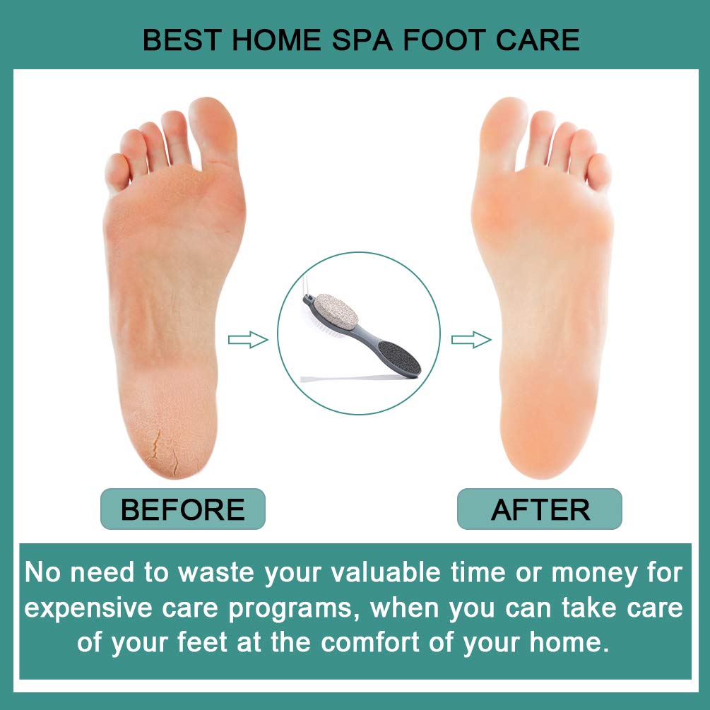 Transform your feet with CAREHOOD Foot File. Genuine care for smooth, soft feet at home. No salon needed!