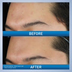 CeraVe Acne Foaming Cream Wash - Side Profile & Box Packaging | original imported packaging available on Curat Cart India