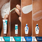 CeraVe Acne Skin Care Set - Back Label & Ingredients Details | fast dispatch across India from Curat Cart