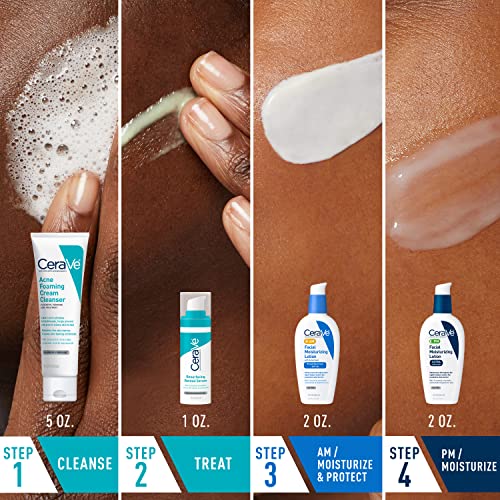 CeraVe Acne Skin Care Set - Back Label & Ingredients Details | fast dispatch across India from Curat Cart