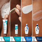 CeraVe Acne Skin Care Set - Back Label & Ingredients Details | buy 100% authentic product online in India via Curat Cart