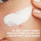 CeraVe Clay To Foam Acne Wash - Side Profile & Box Packaging | buy online in India with doorstep delivery at Curat Cart
