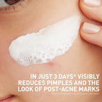 CeraVe Clay To Foam Acne Wash - Texture, Swatch & Consistency | fast dispatch across India from Curat Cart