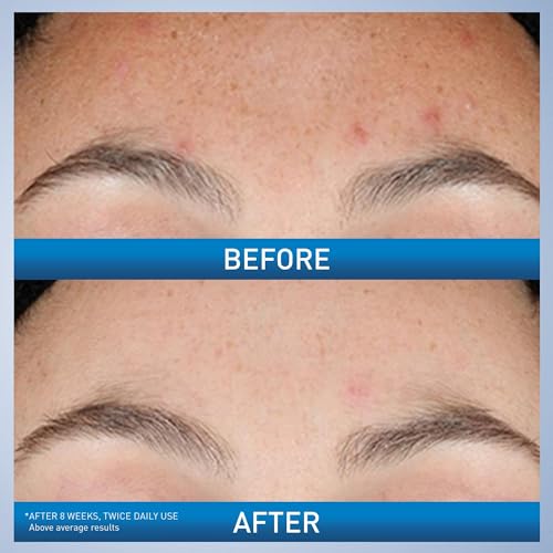 CeraVe Resurfacing Retinol Serum - Side Profile & Box Packaging | buy online in India with doorstep delivery at Curat Cart