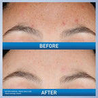 CeraVe Resurfacing Retinol Serum - Side Profile & Box Packaging | buy online in India with doorstep delivery at Curat Cart
