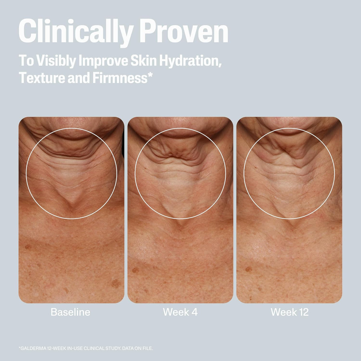 Clinical results showing Cetaphil Hydrating Firming Body Lotion's effects on skin hydration and texture over 12 weeks.