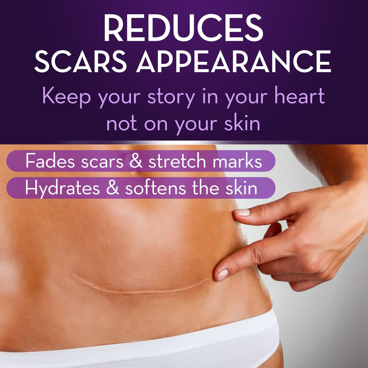 Cicatricure Advanced Scar Gel helps fade scars and stretch marks. Order online in India for smoother skin today.