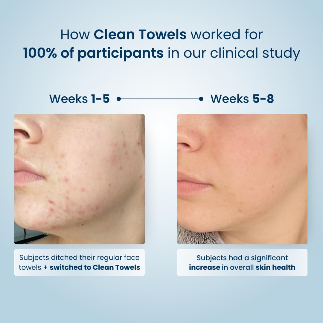 Discover Clean Skin Club Clean Towels, a premium imported solution that transformed skin health for 100% of participants.