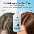 CURAT CART Anti-Dandruff Shampoo - Back Label & Ingredients Details | buy 100% authentic product online in India via Curat Ca