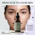 CURAT CART Salicylic Acid Face Serum - Application & Usage Demonstration | buy online in India with doorstep delivery at Cura