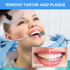 Transform your smile with the Dental Tools Plaque Remover Kit. 100% Authentic, available at Curat Cart in India.