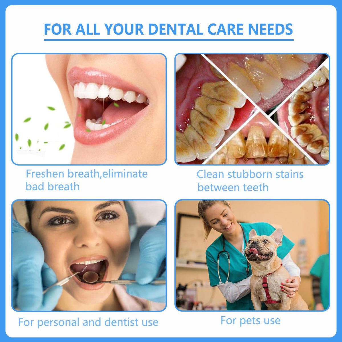 Premium imported Dental Tools Plaque Remover Kit for effective oral care. Ideal for personal and professional use. Available at Curat Cart.