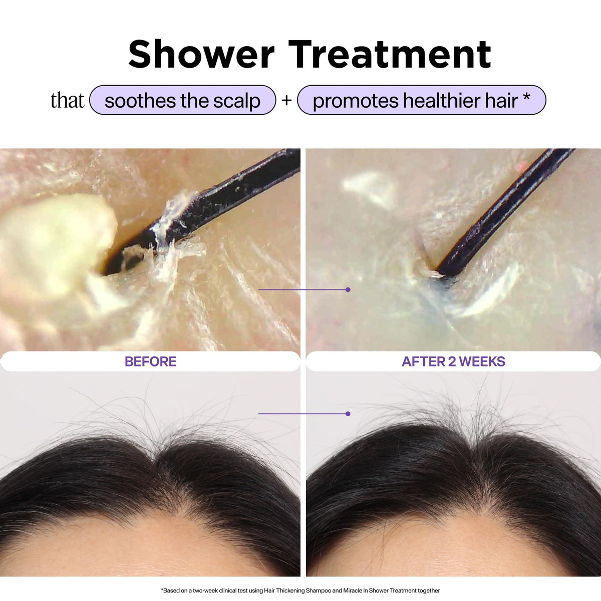 Experience healthier hair with Dr. Groot Miracle Shower Treatment. Order now online, available in India.