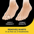 Dr. Scholl's Wart Remover Bandages show effective application on foot, promising visible results in just 2 treatments. Available at Curat Cart.