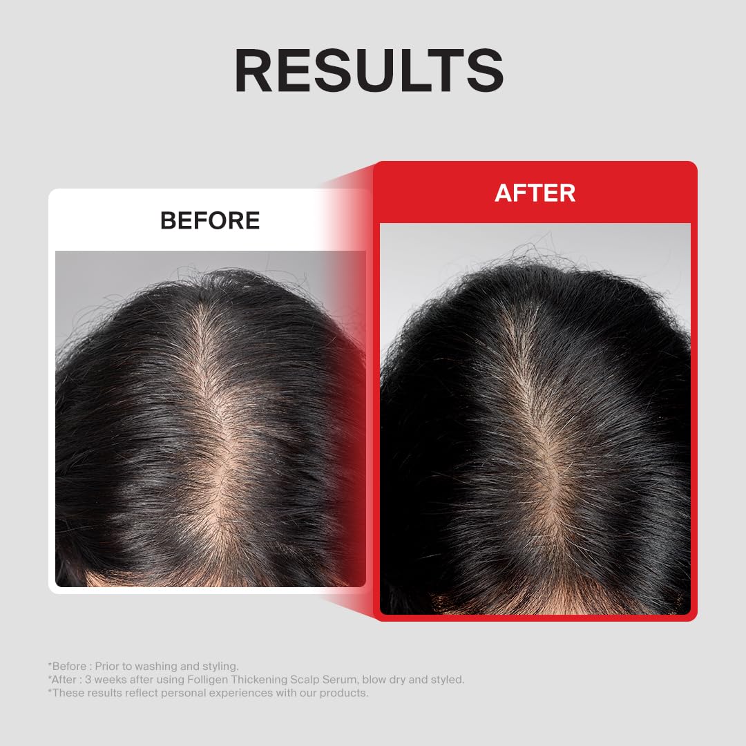 Transform your hair with Dr.FORHAIR Folligen Thickening Serum. See visible results in just weeks. Available at Curat Cart.