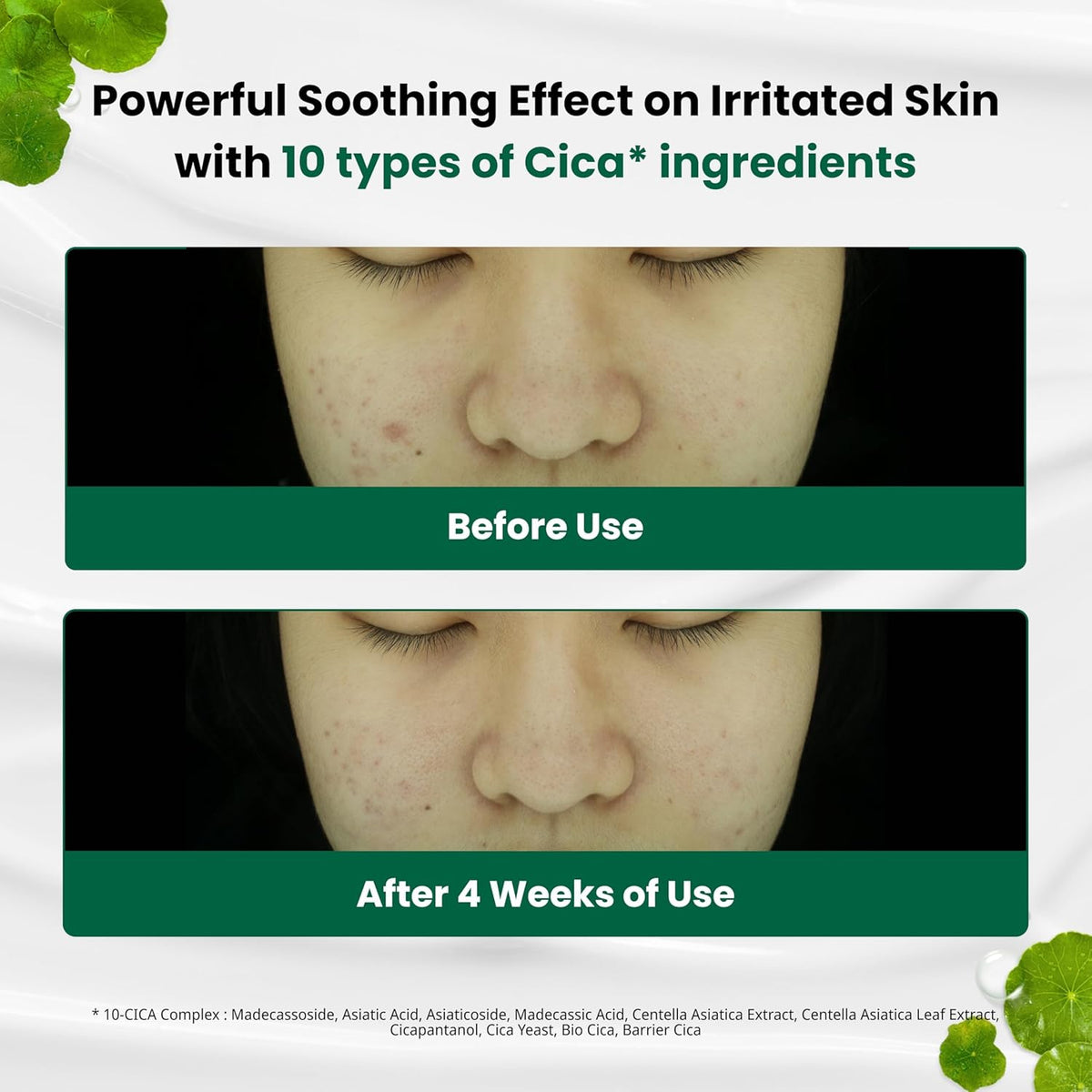 Transform your skin with Dr.G Red Blemish Clear Cream. Verified by CuratCart for effective blemish care. See results in 4 weeks.