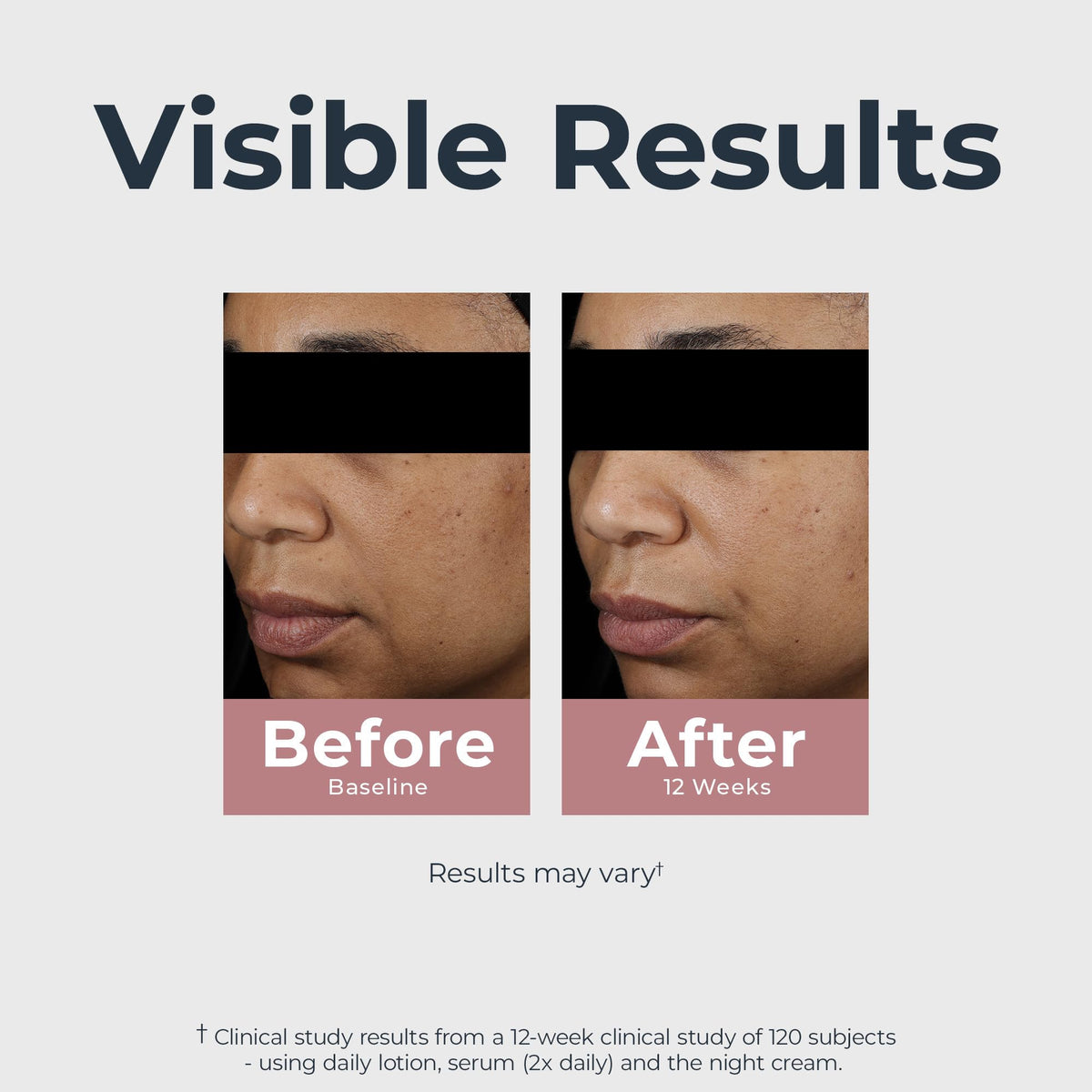 See visible results with Eucerin Radiant Tone Night Cream. Verified by CuratCart, your trusted skincare source.