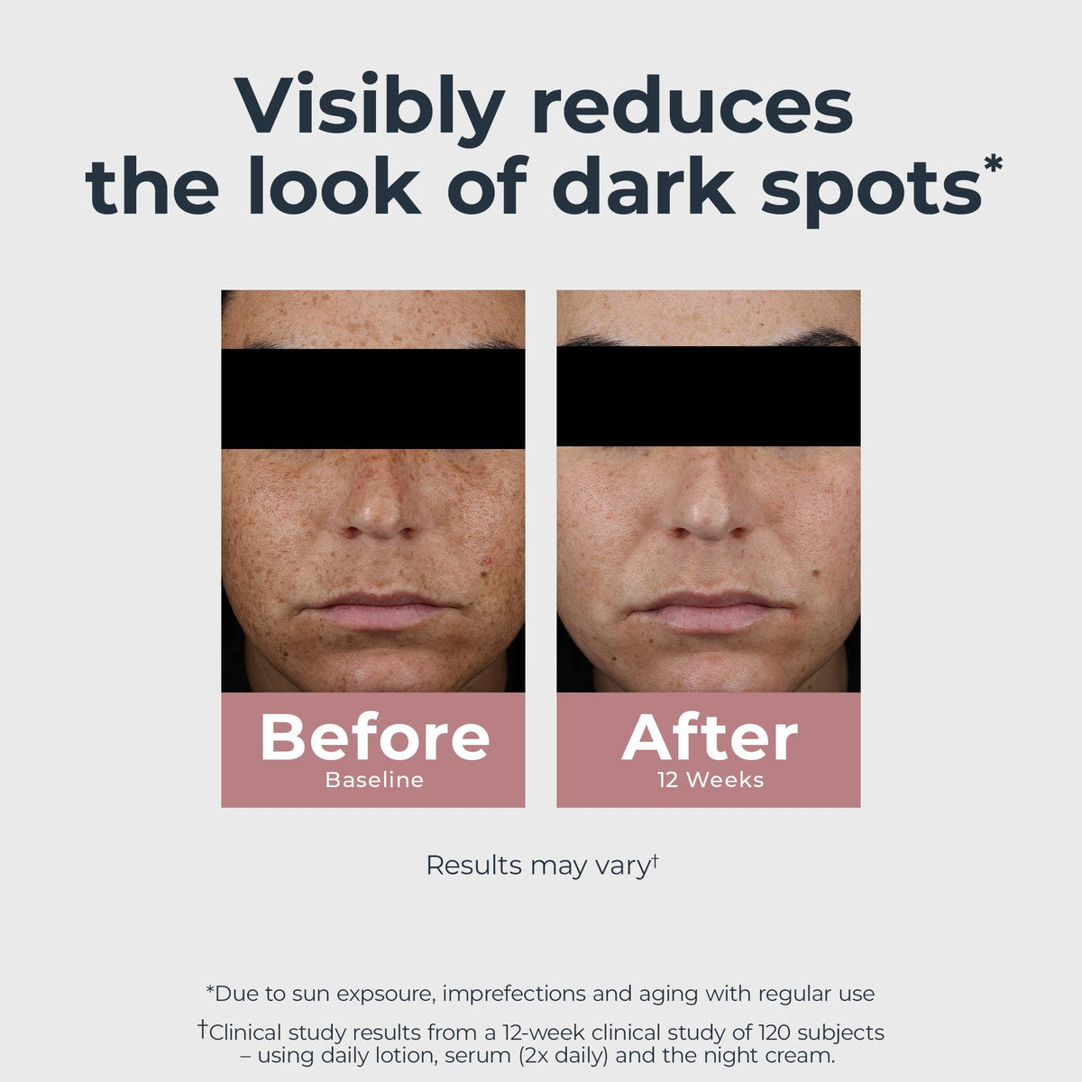 Eucerin Radiant Tone Night Cream visibly reduces dark spots, showcasing impressive results from a 12-week study.
