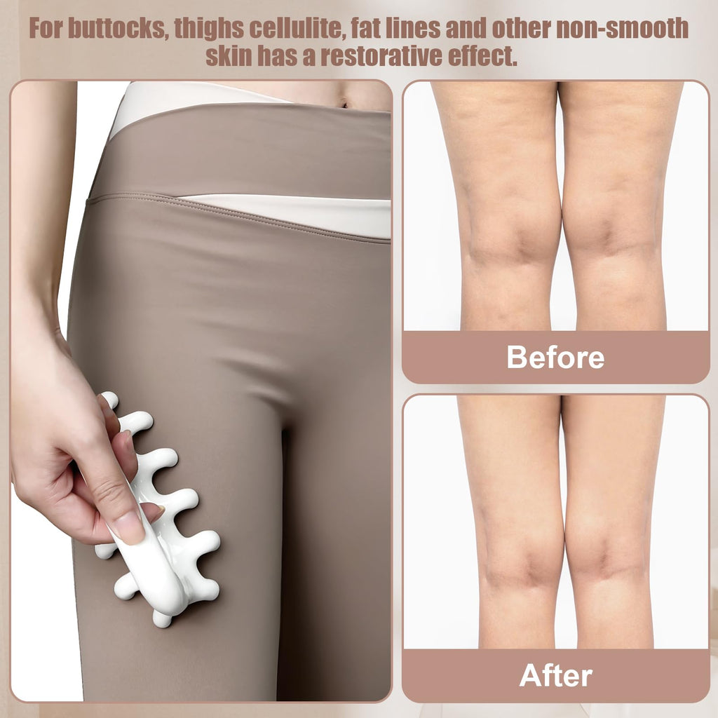 Enhance your wellness routine with the Fascia Massage Tool Trigger Point, effective for cellulite and skin restoration. Available at Curat Cart.