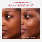 Experience the First Aid Beauty Hydrating Gel Cream, leaves skin dewy and radiant. 100% Authentic, available at Curat Cart.