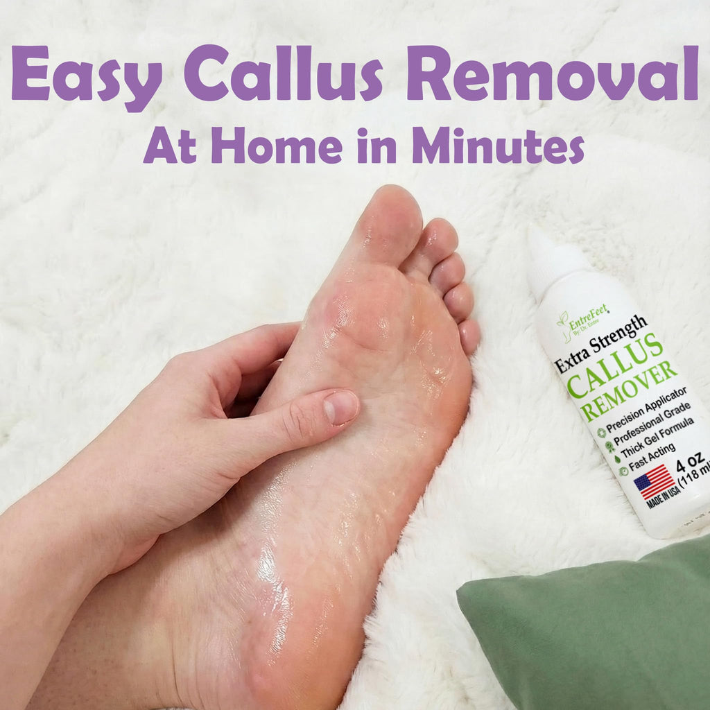 Experience easy callus removal at home with Extra Strength Callus Remover Gel from Curat Cart. Perfect for smooth feet in minutes.