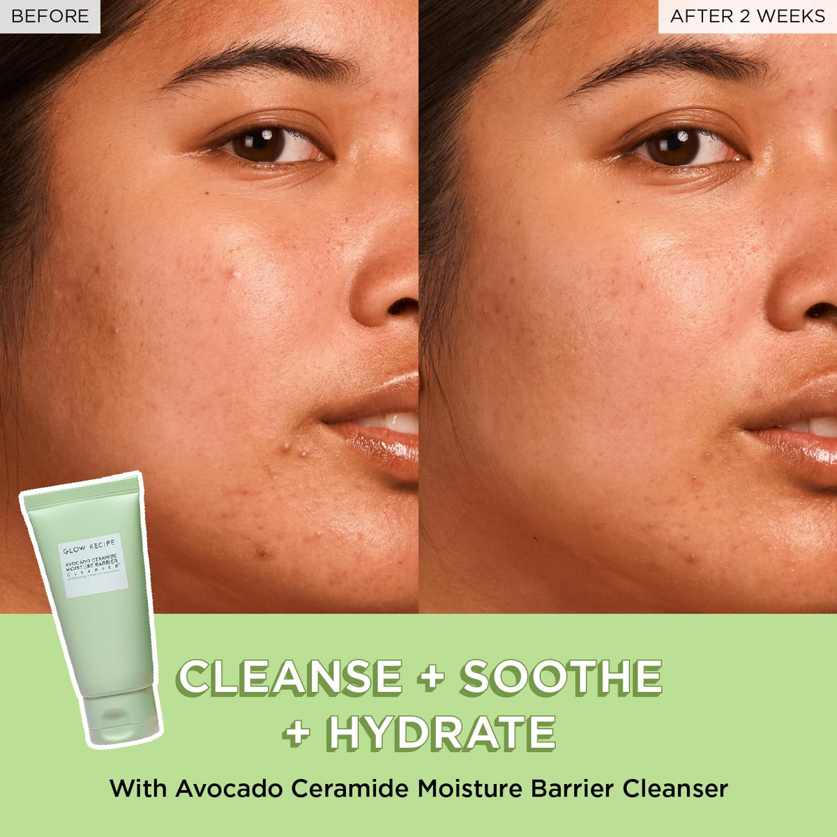 Experience visible skin transformation with Glow Recipe Avocado Ceramide Cleanser. Verified by CuratCart for trusted results.