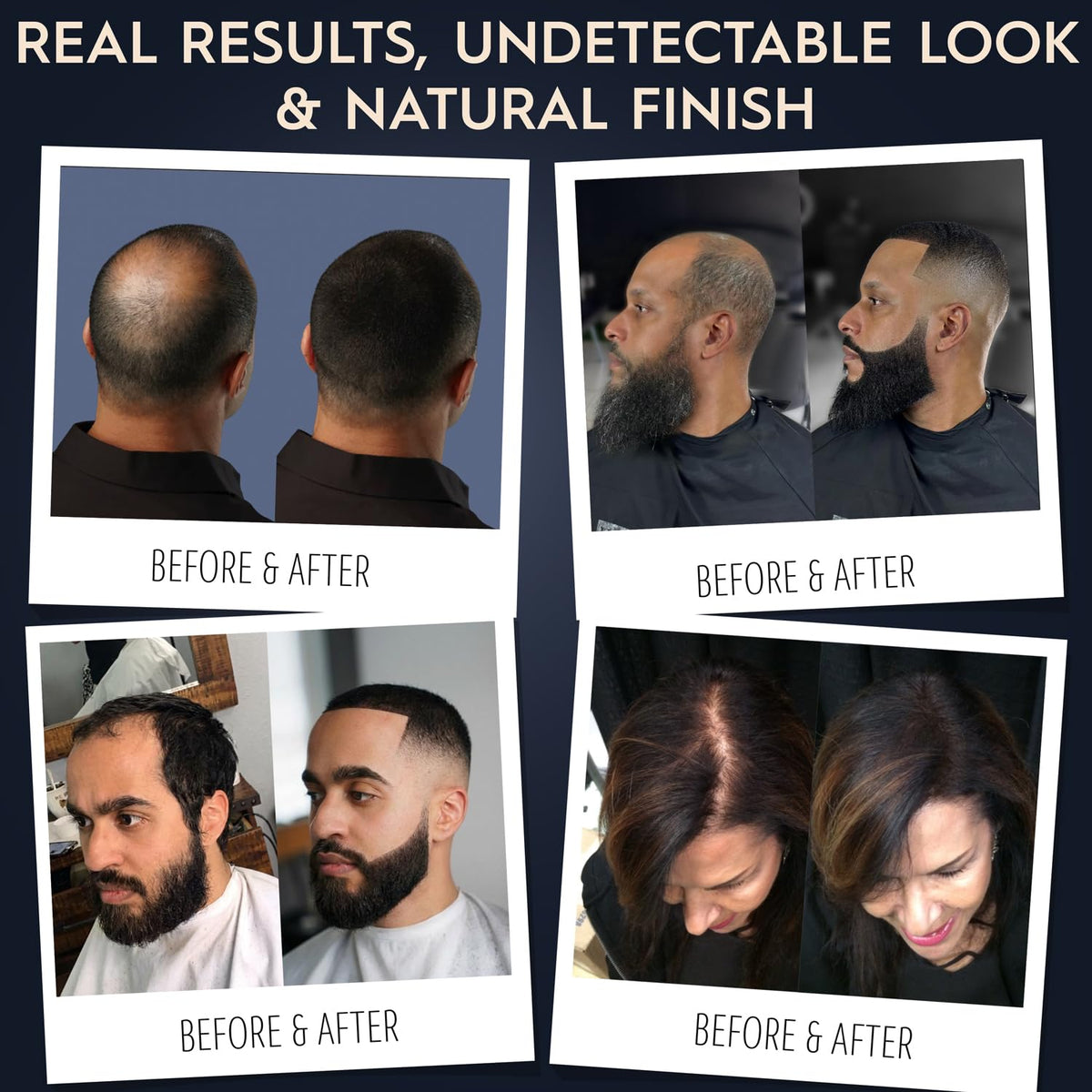Transform your look with Hair Illusion Black Real Hair Fibers for a natural, undetectable finish. Authentic results shown.