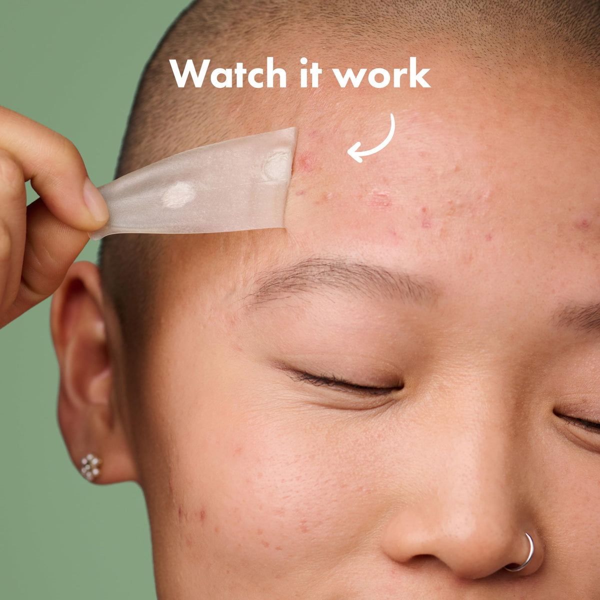 Experience the effectiveness of Hero Cosmetics Mighty Patch Surface, a premium imported solution for acne care.