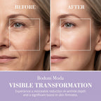 Noor Wonderlift Cream for Women shows visible results in wrinkle reduction and skin firmness. Premium import available at Curat Cart.