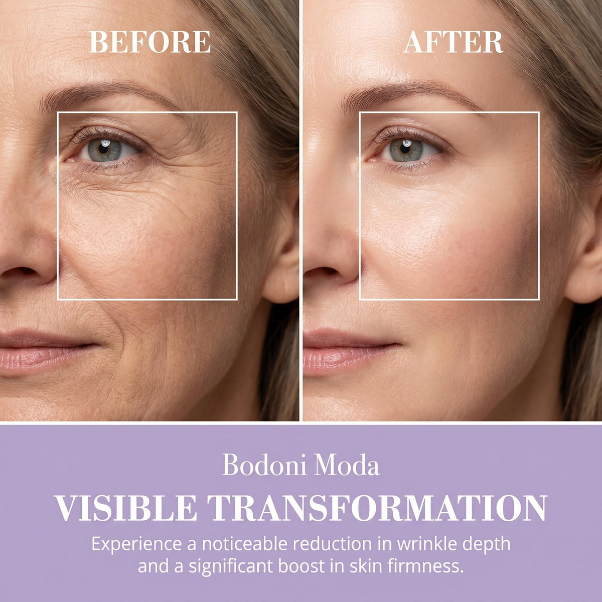 Noor Wonderlift Cream for Women shows visible results in wrinkle reduction and skin firmness. Premium import available at Curat Cart.