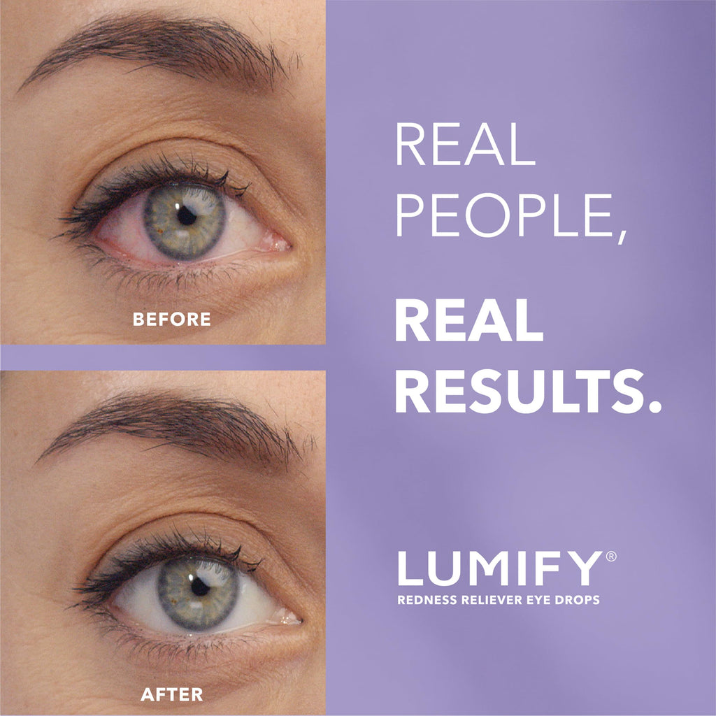 Lumify Redness Relief Eye Drops deliver visible results for eye redness. 100% Authentic, available at Curat Cart in India.