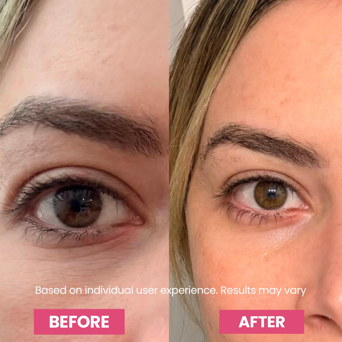 Transform your under-eye area with Luxe Korean Under Eye Balm, showcasing impressive results in official packaging. Available at Curat Cart.