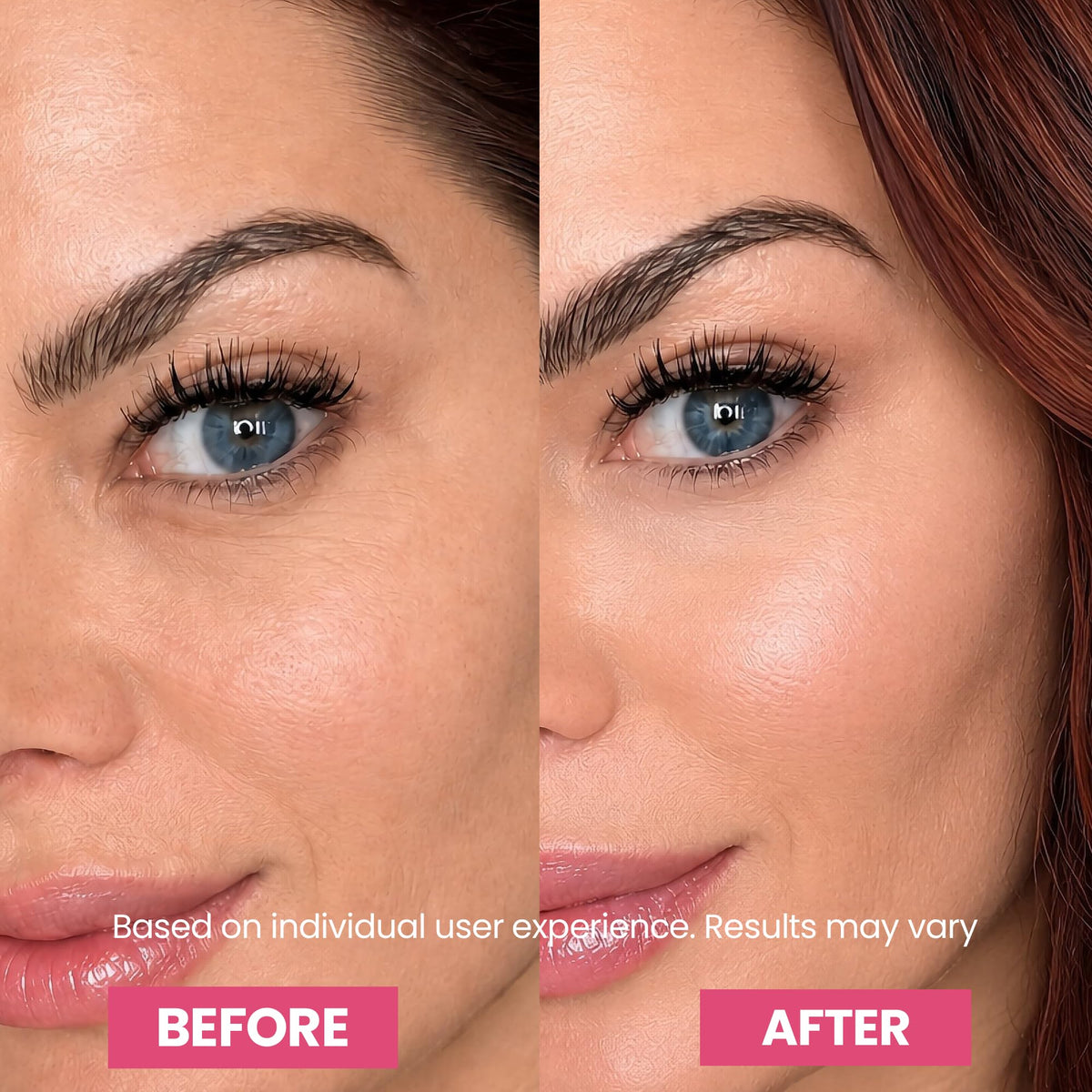 Experience the transformative power of Luxe Korean Under Eye Balm, specially curated by Curat Cart for radiant eyes. Results may vary.