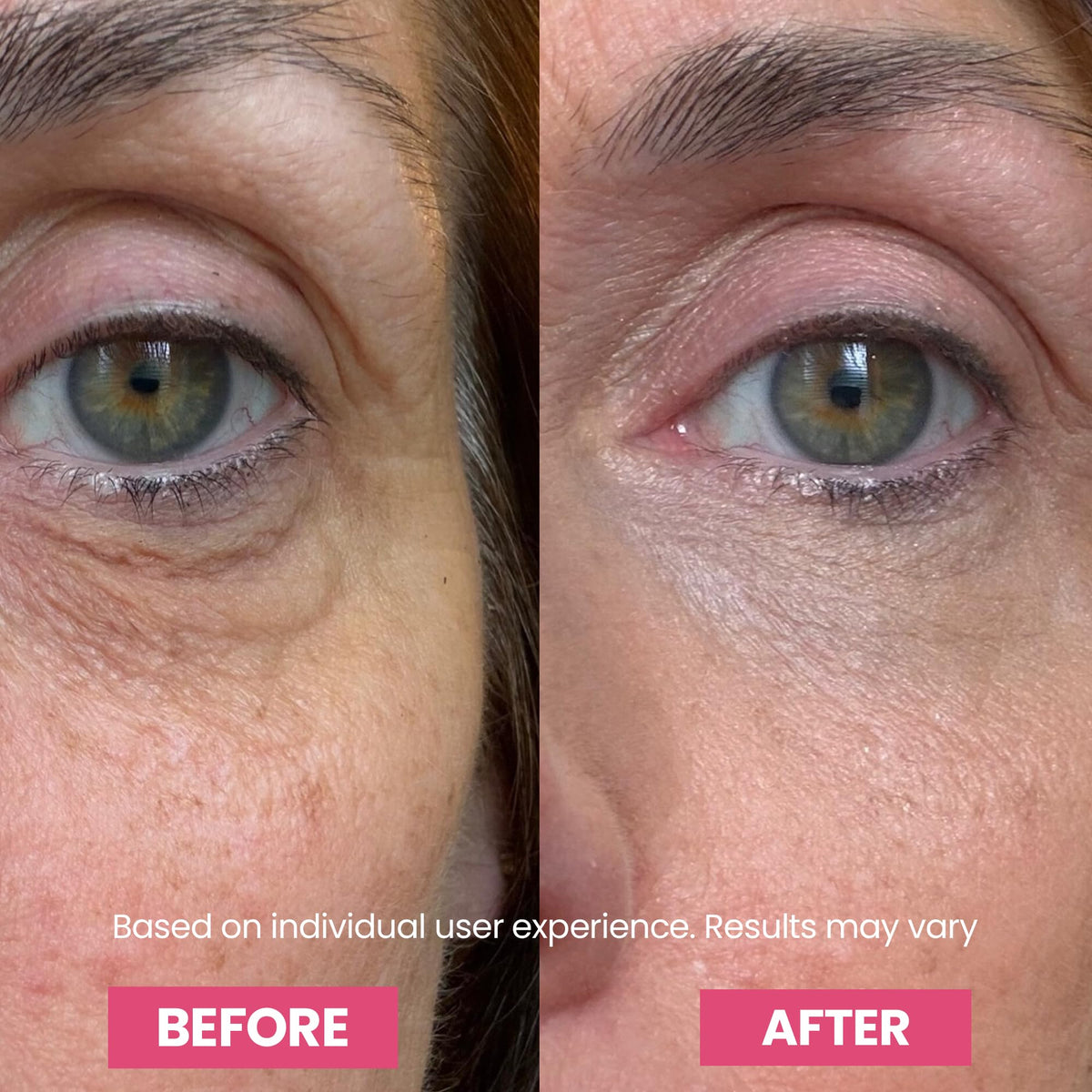 Transform your under-eye area with Luxe Korean Under Eye Balm. Perfect for daily use and visible results. Available at Curat Cart.