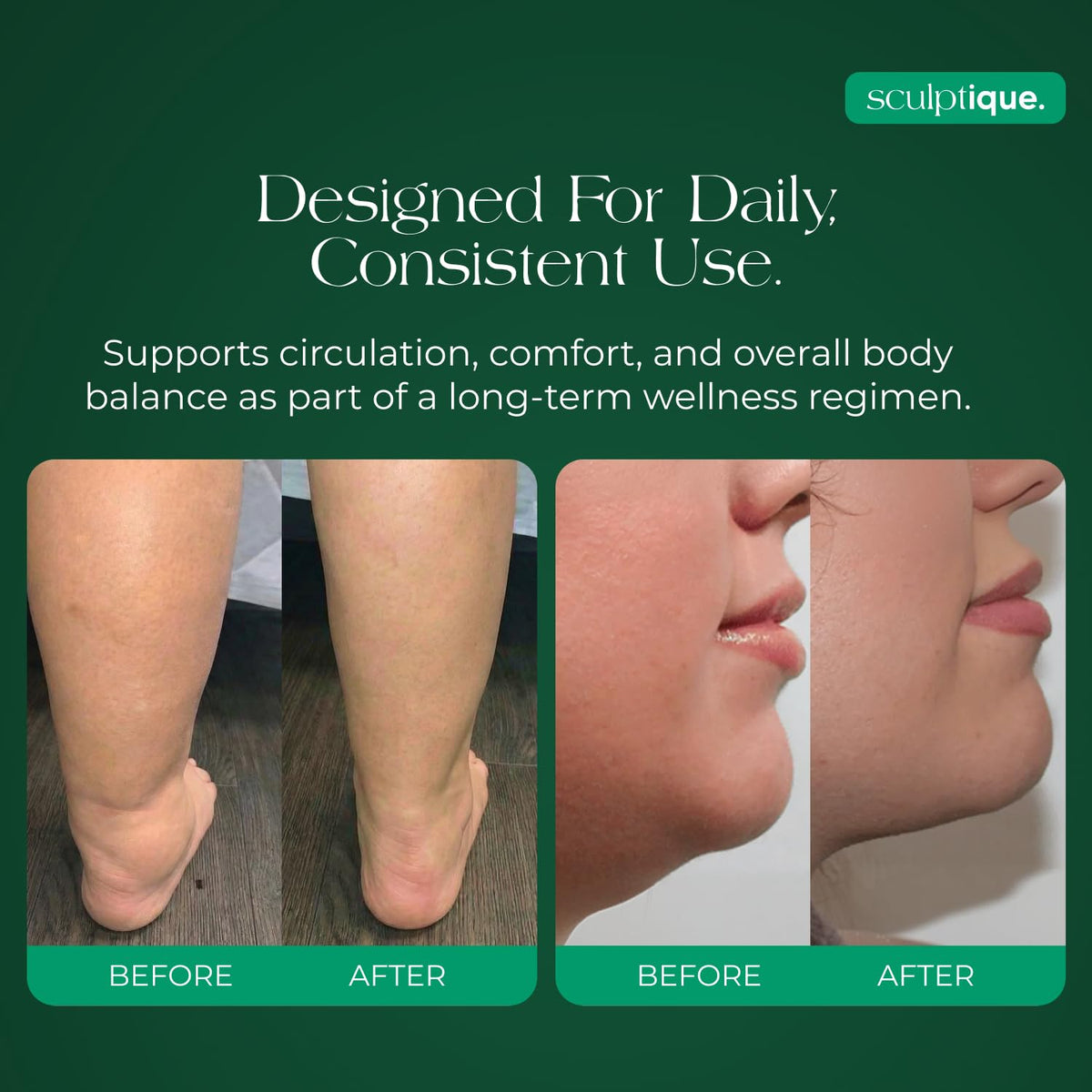 Before and after results showcasing the lymphatic drainage supplement capsules. Verified by CuratCart for quality assurance.