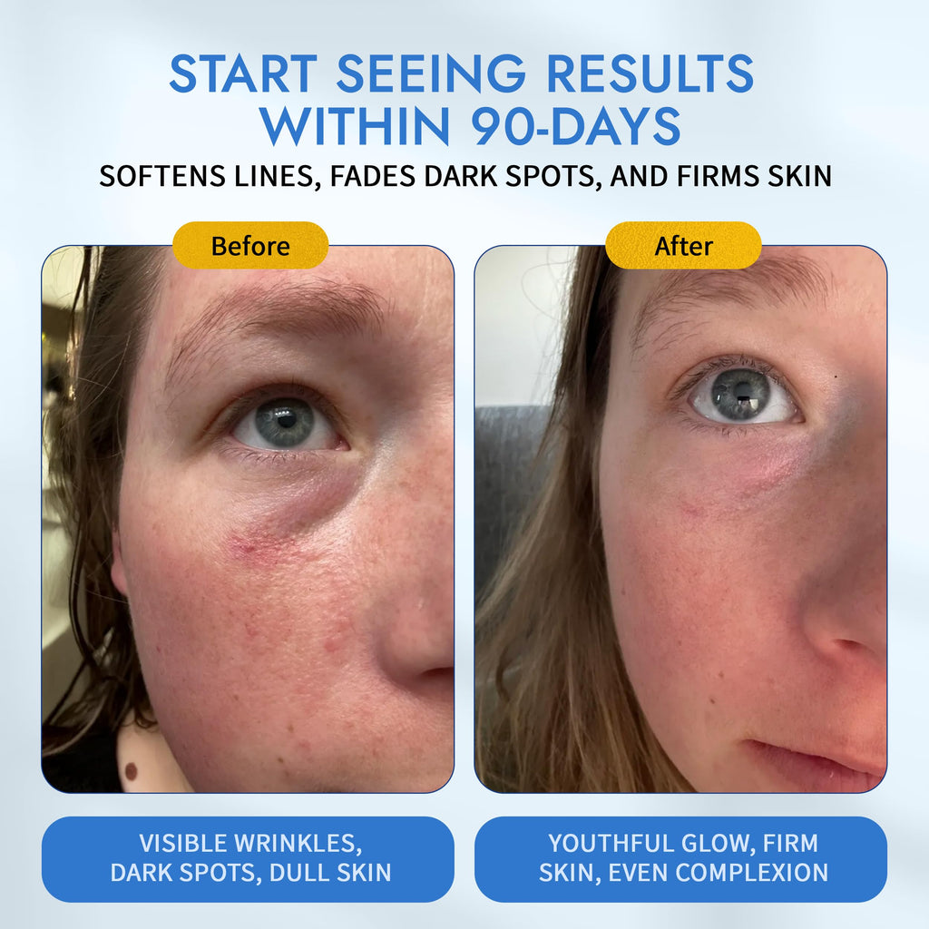 Witness MAELOVE Moonlight Advanced Retinal Serum's effectiveness in reducing wrinkles and dark spots for a youthful glow. Available at Curat Cart.