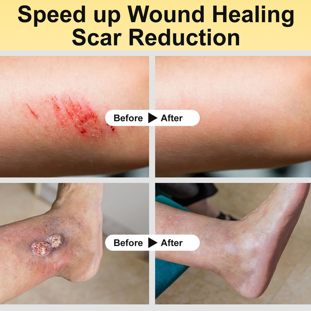 Experience rapid recovery with Manuka Honey for Wounds, ideal for effective scar reduction. Available at Curat Cart.