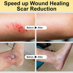 Experience rapid recovery with Manuka Honey for Wounds, ideal for effective scar reduction. Available at Curat Cart.