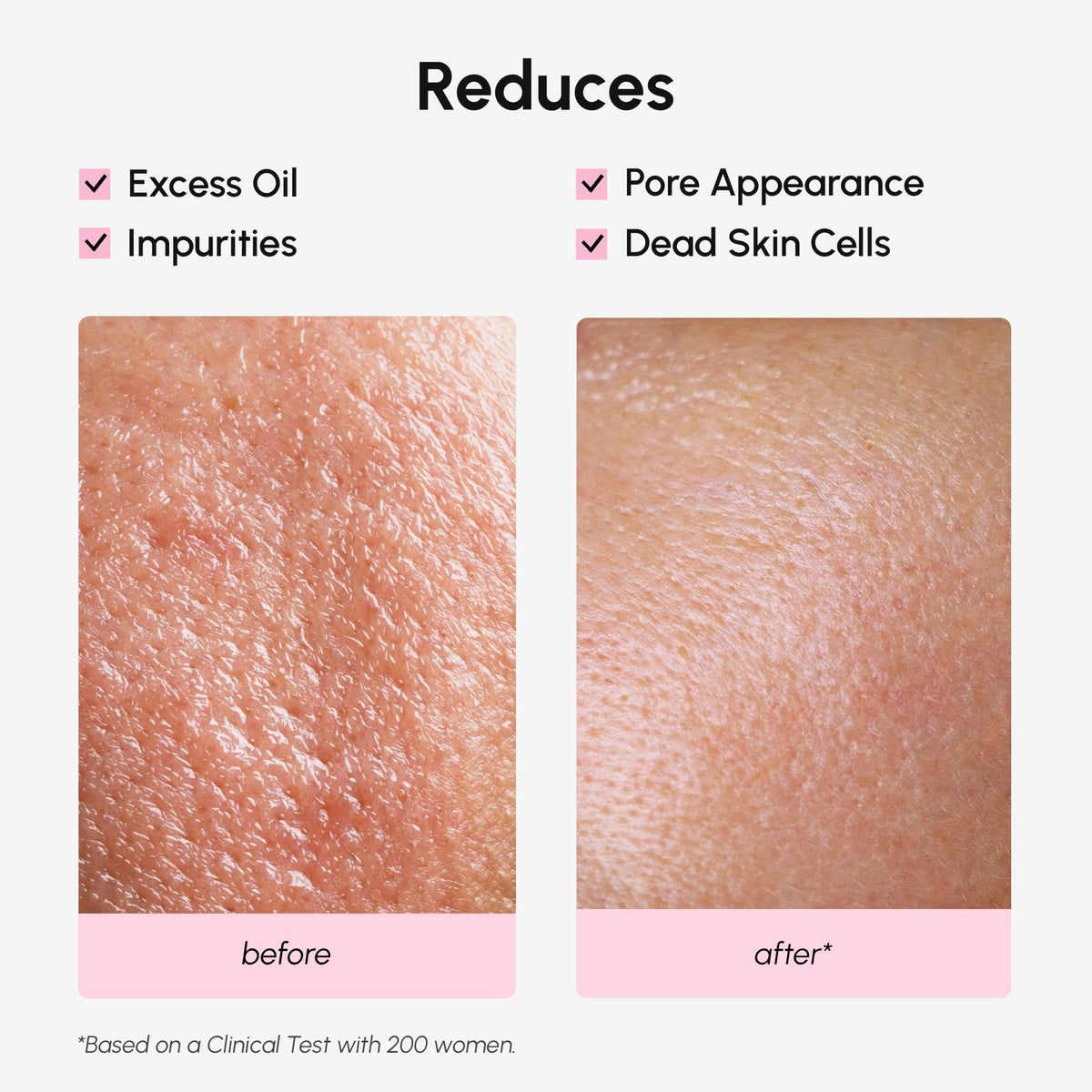 Maree Pore Minimizer Toner shows skin before and after use, highlighting reduced pore appearance and oiliness.