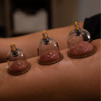 Premium Myofascial Releaser Cupping Set showcased on skin, featuring high-quality transparent cups for effective therapy. Available at Curat Cart.