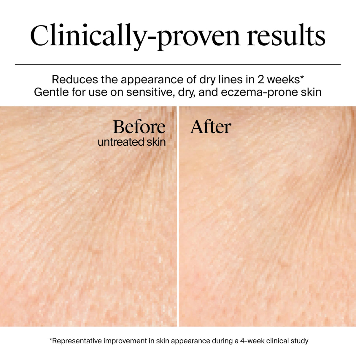 Transform your skin with Neutrogena Hydro Boost Gel Cream, a premium imported solution for hydrated, radiant skin.