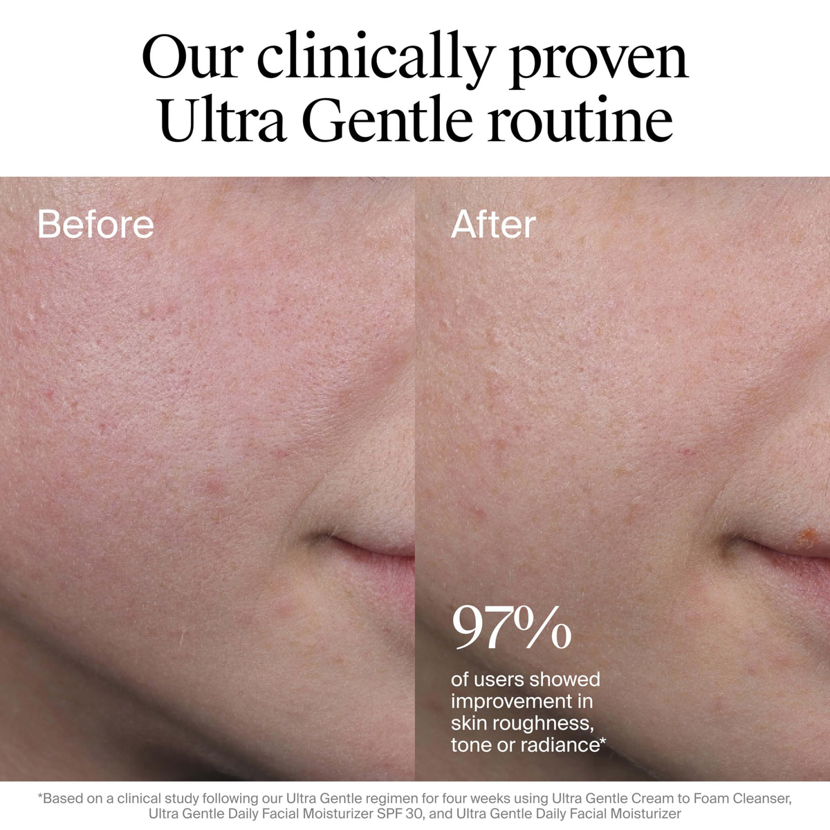 Experience visible skin improvement with Neutrogena Ultra Gentle Facial Moisturizer. Perfect for daily use. Available at Curat Cart.