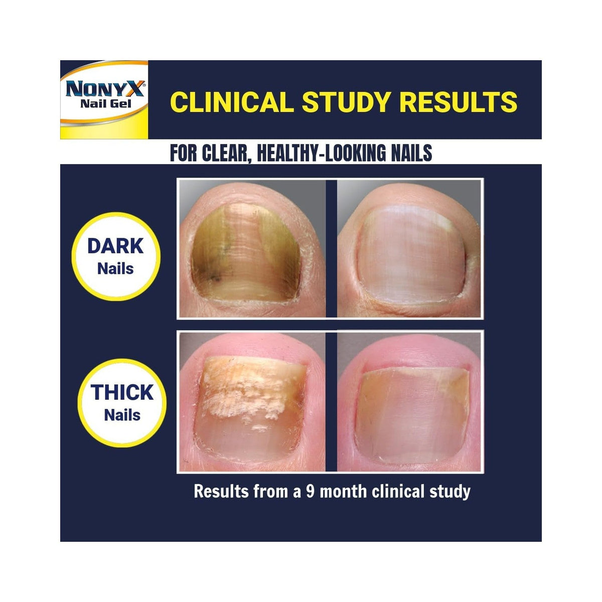 Before and after images showing improved nail health. Verified by CuratCart for quality assurance.