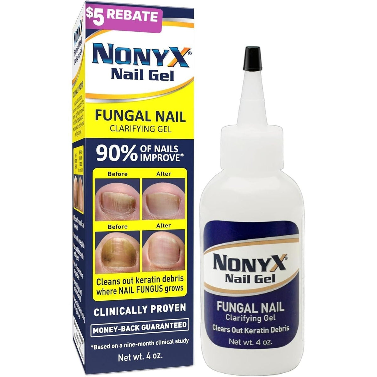 Premium imported NONYX Fungal Nail Gel, clinically proven to clear nail fungus and keratin debris effectively.