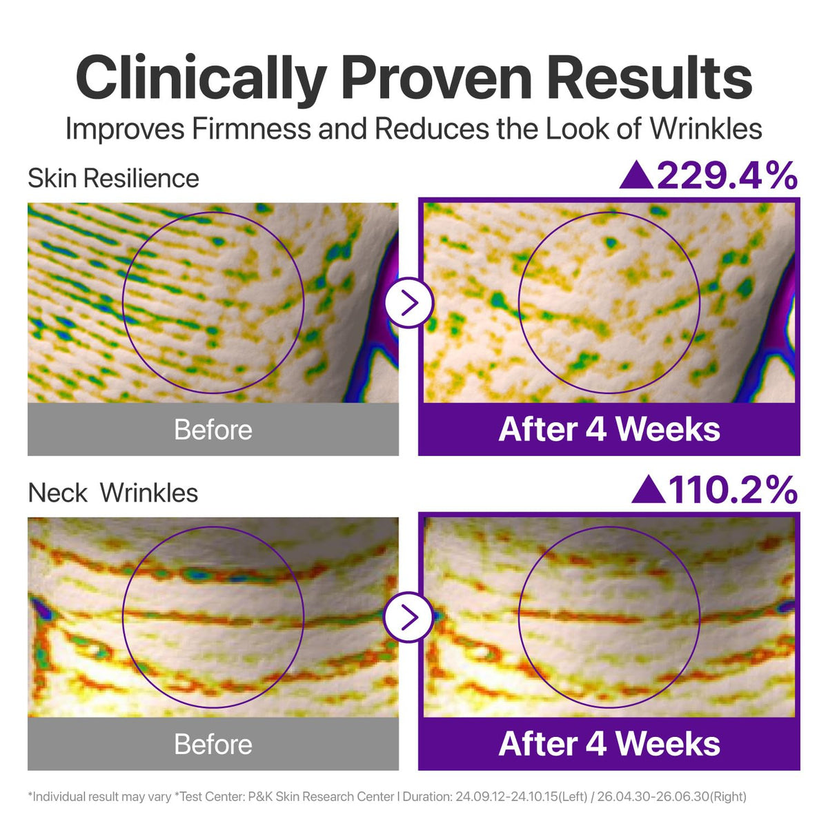 Numbuzin No.9 NAD+ Peptide Serum shows remarkable skin firmness and reduced wrinkles after four weeks of use.