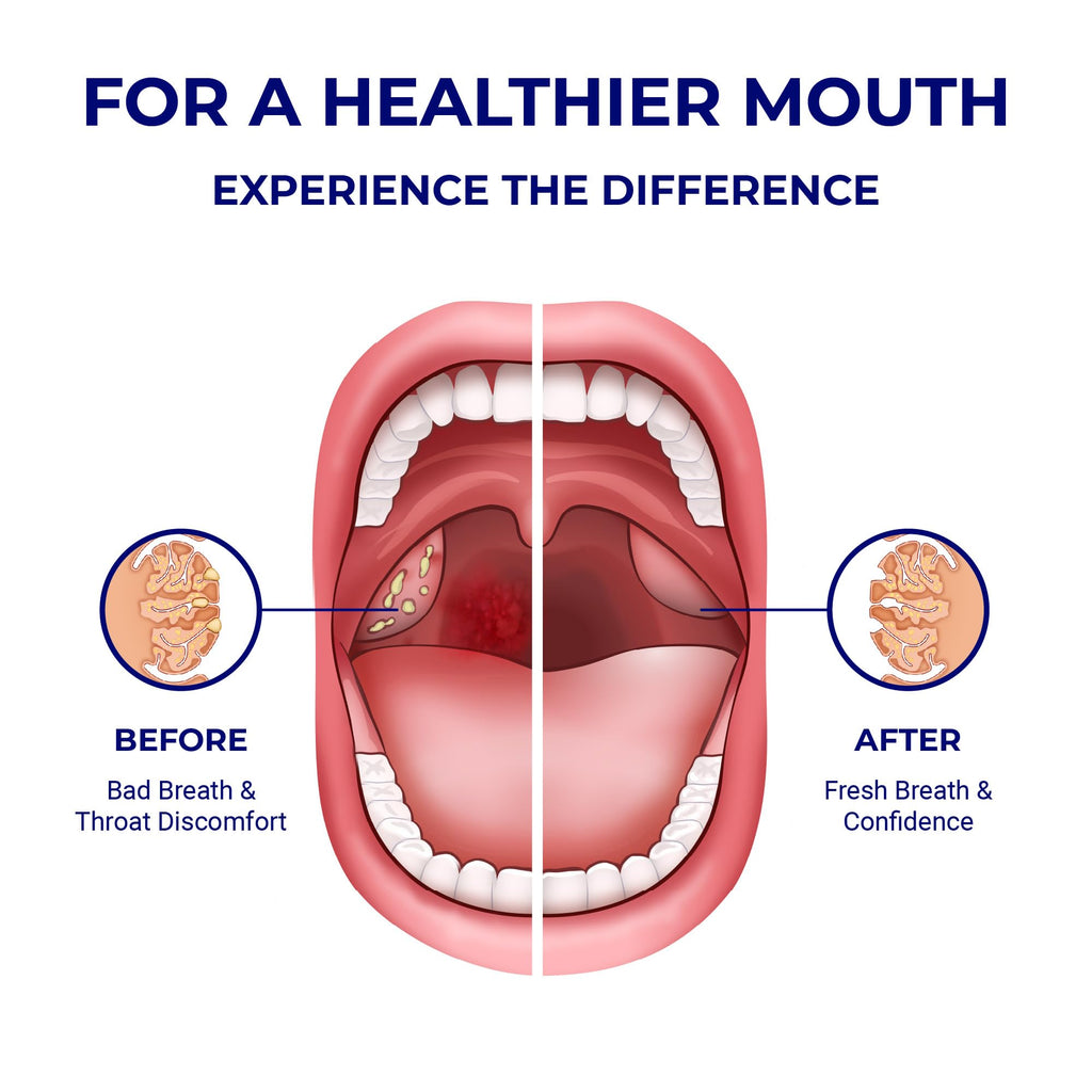 Transform your oral hygiene with Oravix Tonsil Stone Remover Tool. Perfect for fresh breath and confidence. Available at Curat Cart.