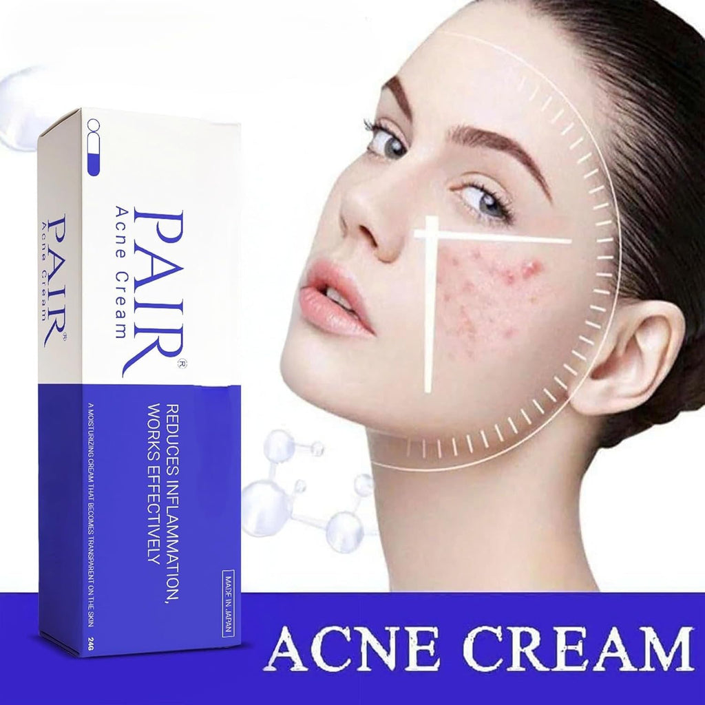 Pair Acne Cream, 14g, reduces inflammation and works effectively for clearer skin. 100% authentic and genuine product.