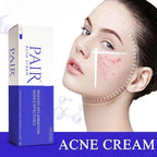 Pair Acne Cream, 14g, reduces inflammation and works effectively for clearer skin. 100% authentic and genuine product.
