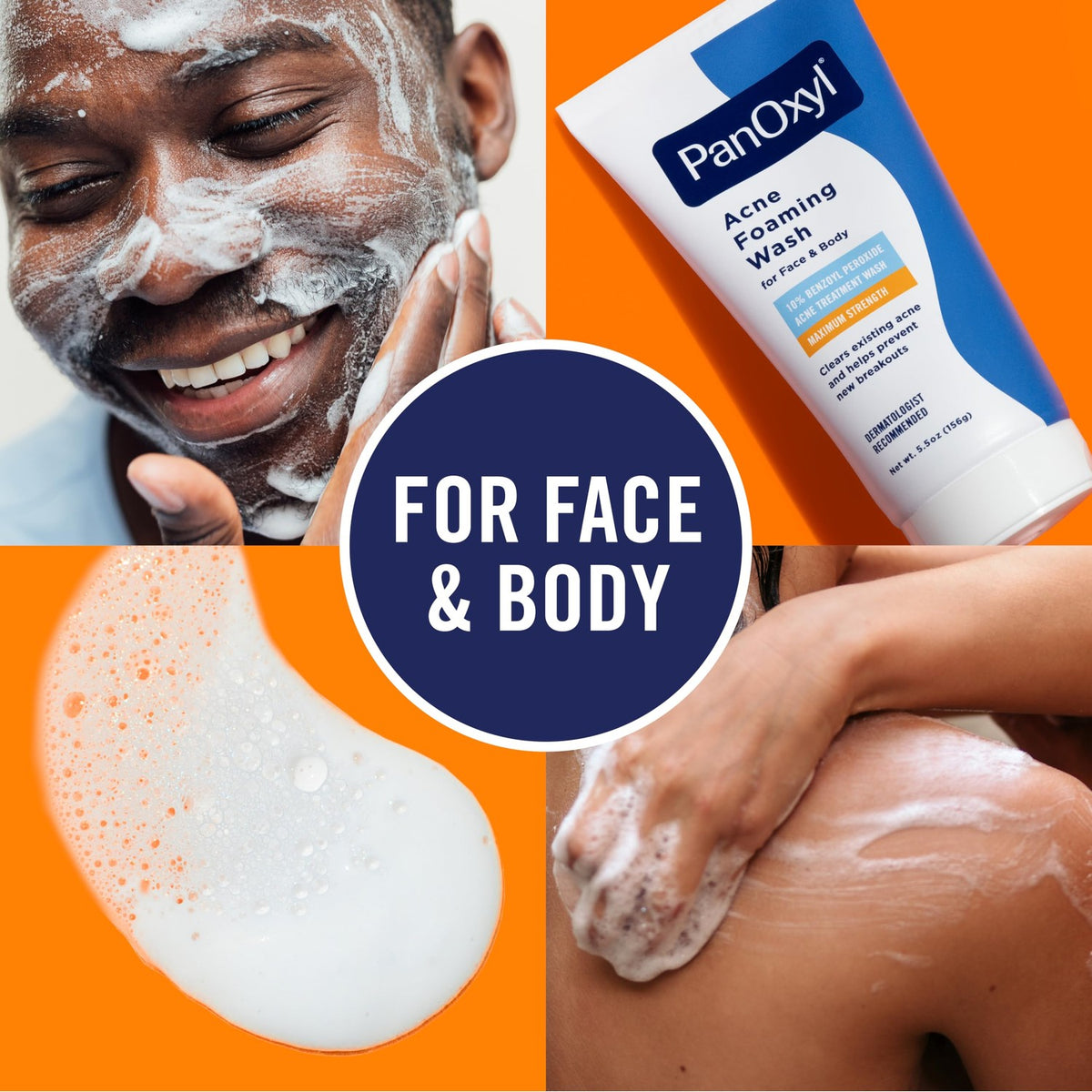 PanOxyl Benzoyl Peroxide Acne Wash for face and body. Original packaging showcases effective formula for clear skin.